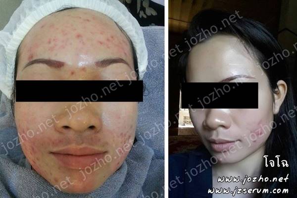 Jz' เจซี คลีนเซอร์ pH5.5 สะอาดอ่อนโยน ล้างหน้า อาบน้ำ สระผมในขวดเดียว : ไร้สี น้ำหอม ซิลิโคน แอลกอฮอล์ SLS พาราเบน ฯ