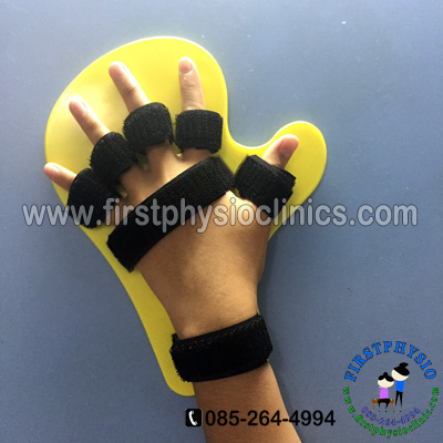 อุปกรณ์ดามกันนิ้วมืองอ /อุปกรณ์กายภาพนิ้ว/อุปกรณ์เหยียดนิ้วมือ/พลาสติกดามข้อมือ/palmar correction splint
