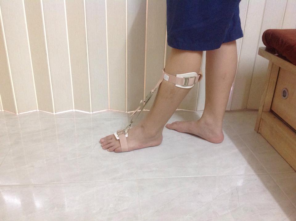 พยุงเท้าตก [Foot Sling] สายรัดกระดกเท้า (Foot up) กันปลายเท้าตก เท้าแกว่ง สายรัดพยุงข้อเท้า สายรัดพยุงปลายเท้า ที่ประคองปลายเท้า