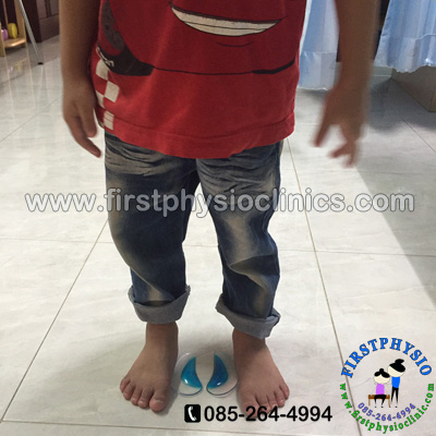 FIRSTPHYSIO/Silicone Gel Arch Support