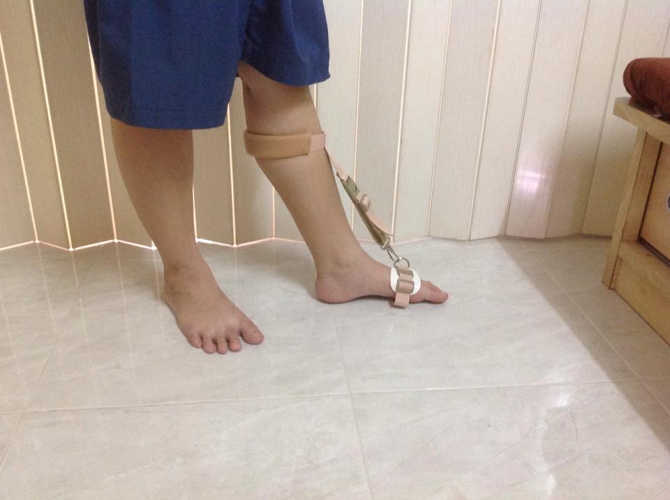 พยุงเท้าตก [Foot Sling] สายรัดกระดกเท้า (Foot up) กันปลายเท้าตก เท้าแกว่ง สายรัดพยุงข้อเท้า สายรัดพยุงปลายเท้า ที่ประคองปลายเท้า