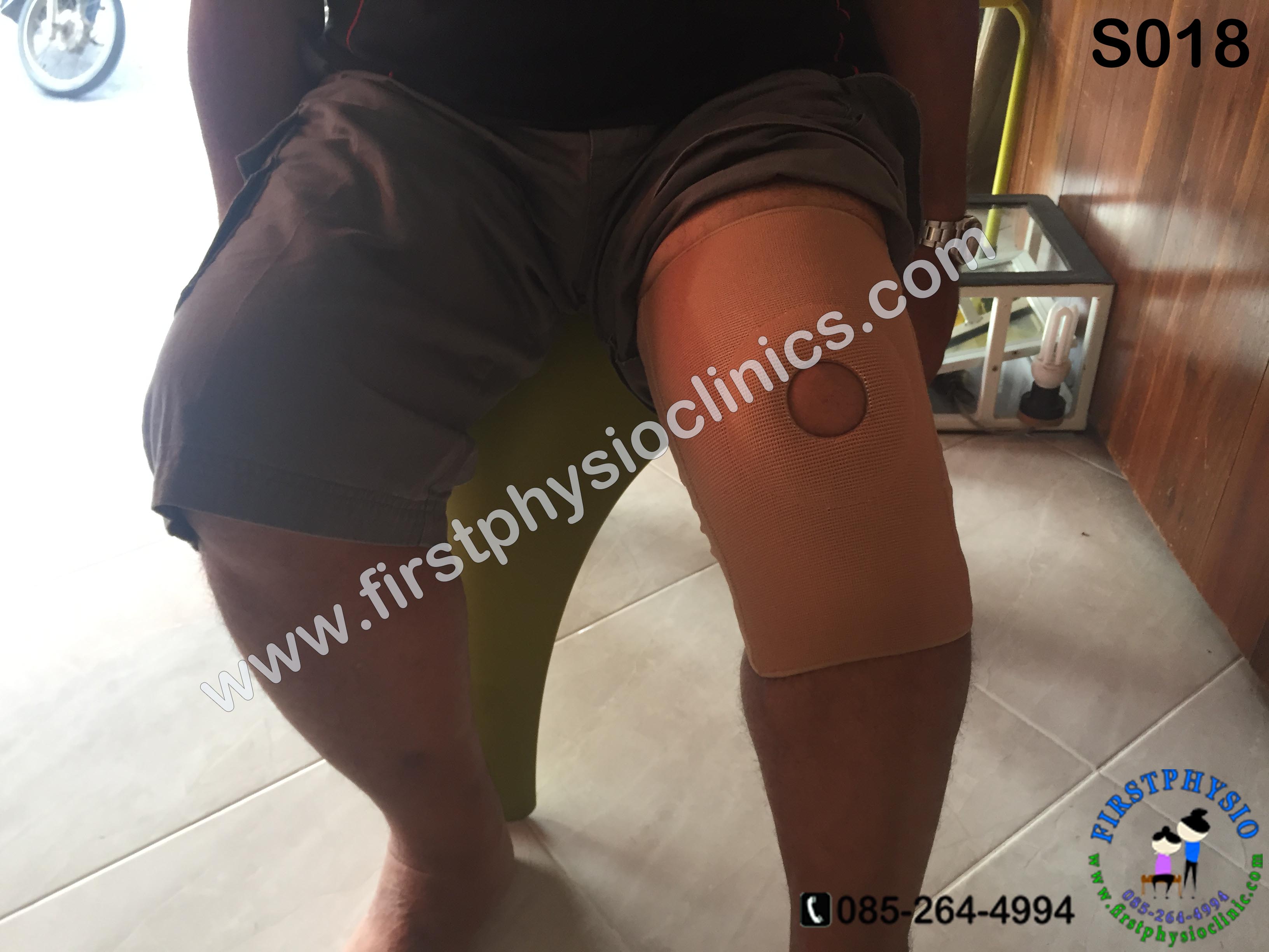 พยุงข้อเข่าและสะบ้าแบบมีแกน พยุงเข่า ที่พยุงเข่า อุปกรณ์พยุงเข่า พยุงหัวเข่ามีแกน2ข้าง Knee Support แบบมีแกน พยุงเข่าแบบมีแกน [Open Patella Flexible Bars]