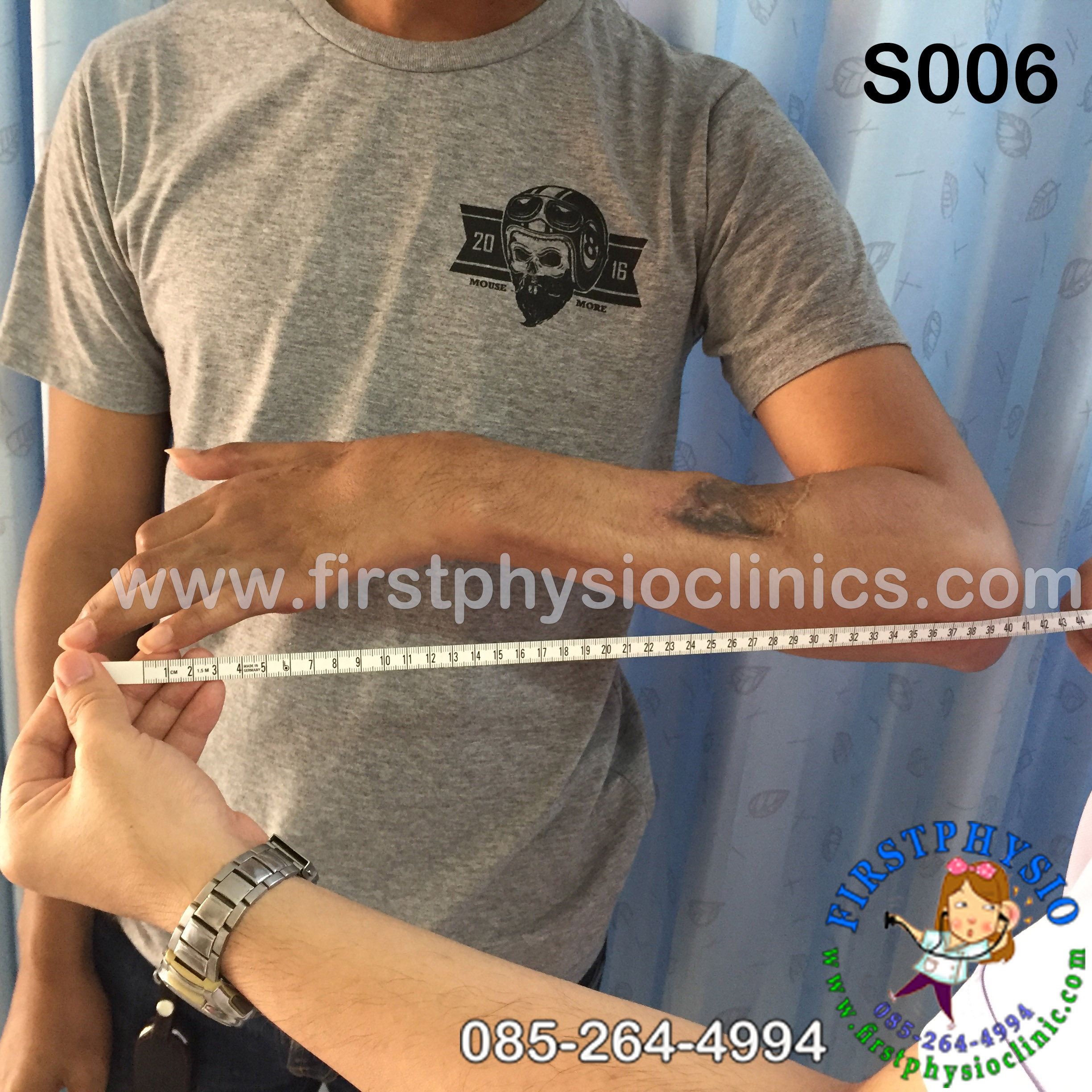 ผ้าคล้องแขน ที่คล้องแขน อุปกรณ์ผ้าคล้องแขน ผ้าคล้องแขน แบบตาข่าย ผ้าคล้องแขนตอนใส่เฝือก ผ้าคล้องแขน ช่วยในการพยุงแขน Arm sling