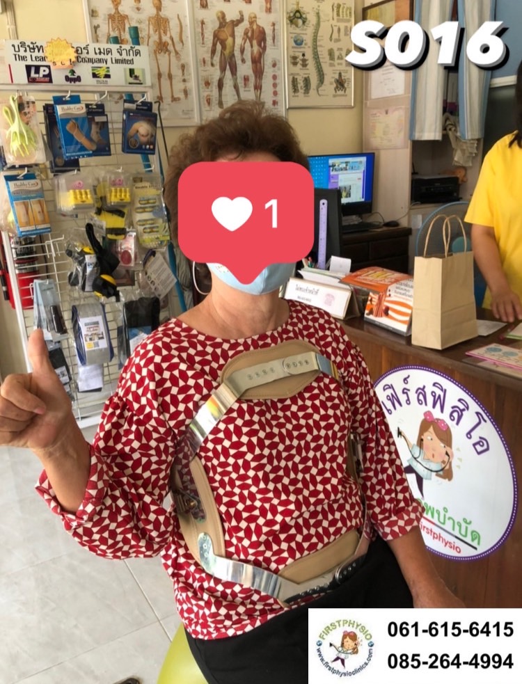 พยุงหลังโครงเหล็กด้านหน้า เจเวท พยุงลำตัวกระดูกทรุด ป้องกันการโค้งงอของหลังมาด้านหน้า,ด้านหลัง,ด้านข้าง Jewett Brace