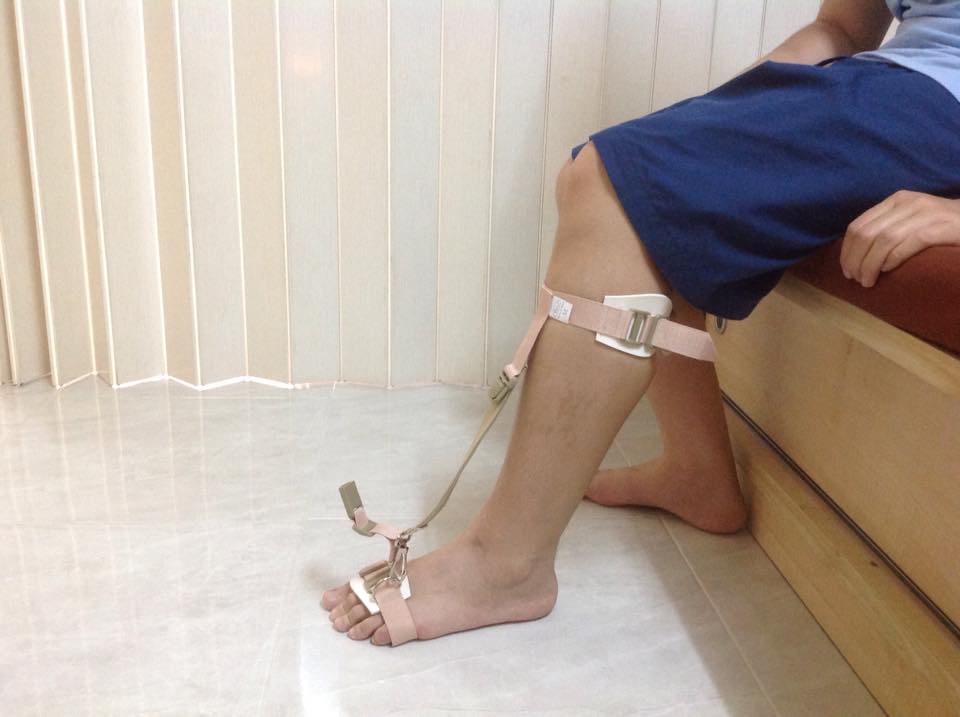 พยุงเท้าตก [Foot Sling] สายรัดกระดกเท้า (Foot up) กันปลายเท้าตก เท้าแกว่ง สายรัดพยุงข้อเท้า สายรัดพยุงปลายเท้า ที่ประคองปลายเท้า
