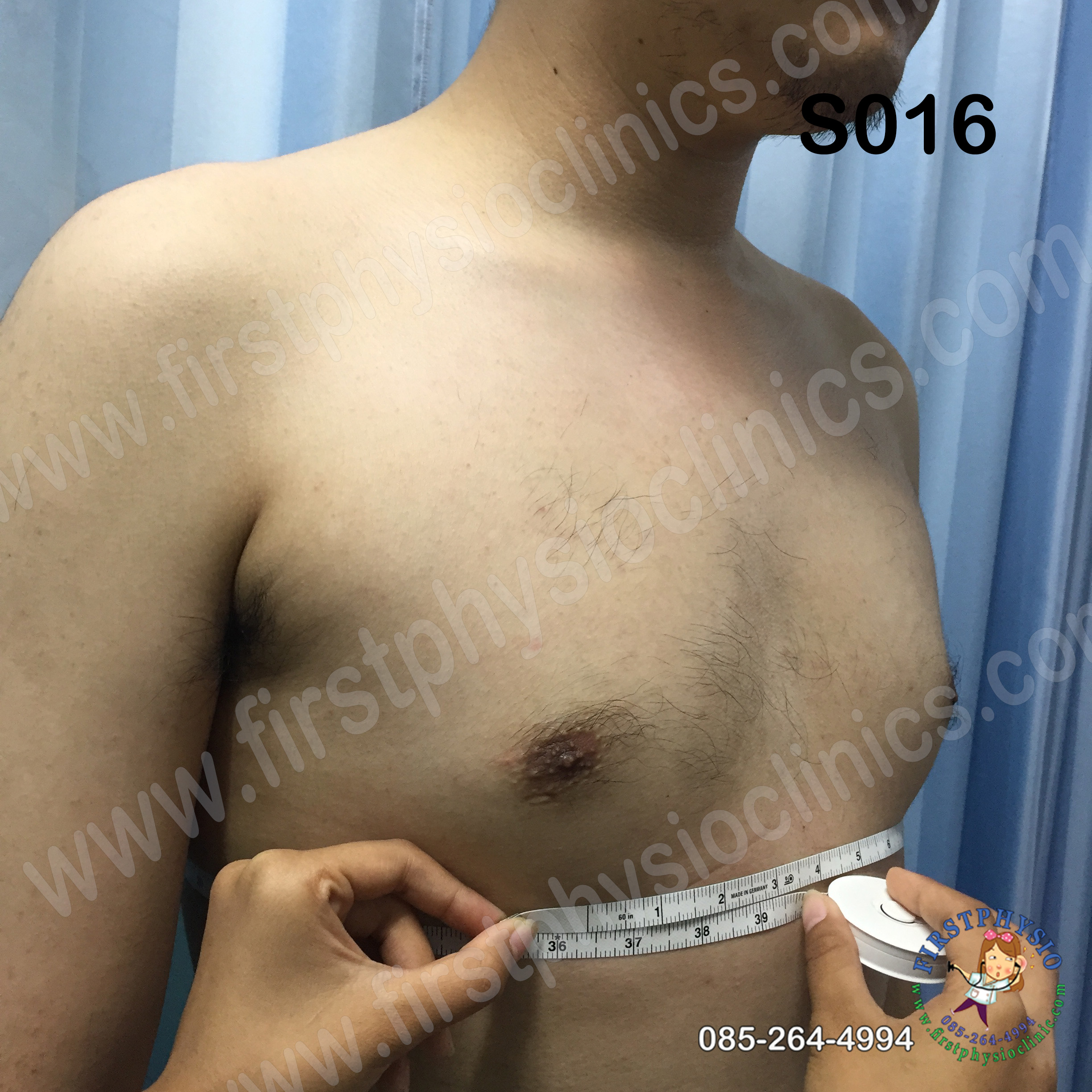 พยุงหลังโครงเหล็กด้านหน้า เจเวท พยุงลำตัวกระดูกทรุด ป้องกันการโค้งงอของหลังมาด้านหน้า,ด้านหลัง,ด้านข้าง Jewett Brace