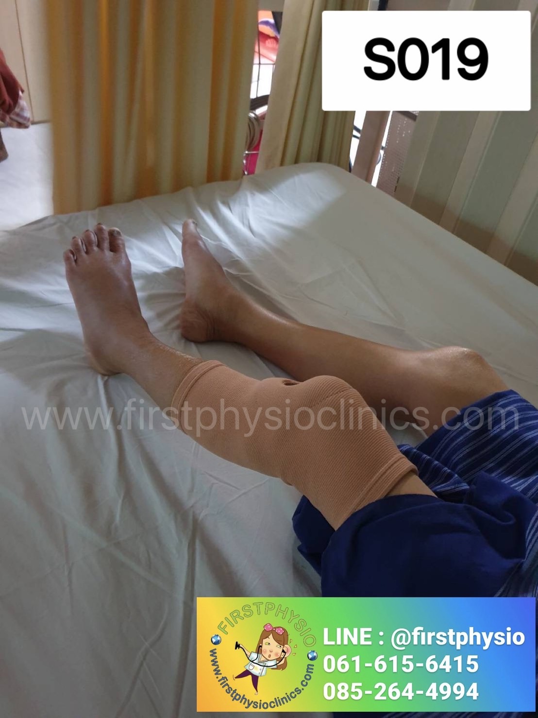 ผ้ายืดลดเข่า พยุงข้อเข่า ที่พยุงข้อเข่า พยุงเข่า สายรัดเข่า อุปกรณ์พยุงเข่า อุปกรณ์พยุงเข่า (Knee Support)ไม่มีแกนด้านข้าง [Knee Support]