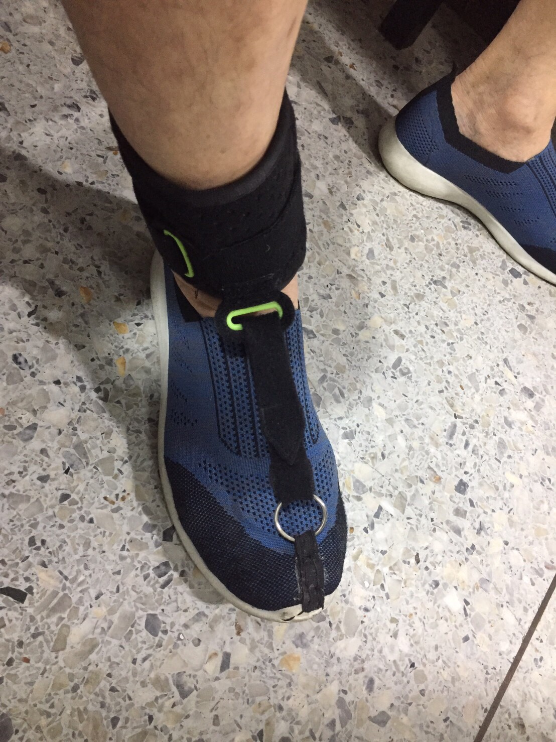 สายรัดกระดกเท้า (Foot up)/อุปกรณ์กันปลายเท้าตก/เท้าแกว่ง/สายรัดพยุงข้อเท้า/สายรัดพยุงปลายเท้า/ที่ประคองปลายเท้า