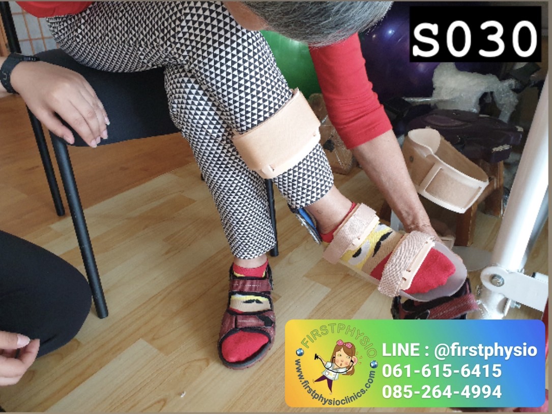 ดามกันปลายเท้าตกแบบปรับองศา (AFO Gait Assist) กันปลายเท้าตก เท้าแกว่ง ดามข้อเท้า ดามปลายเท้า ที่ประคองปลายเท้า