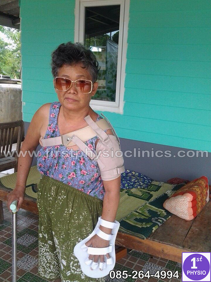 พยุงข้อไหล่หลวม พยุงไหล่ ที่พยุงไหล่ สายรัดพยุงไหล่ปรับได้ ประคองหัวไหล่ สายรัดไหล่ สายรัดพยุงไหล่ shoulder support Bobath Sling