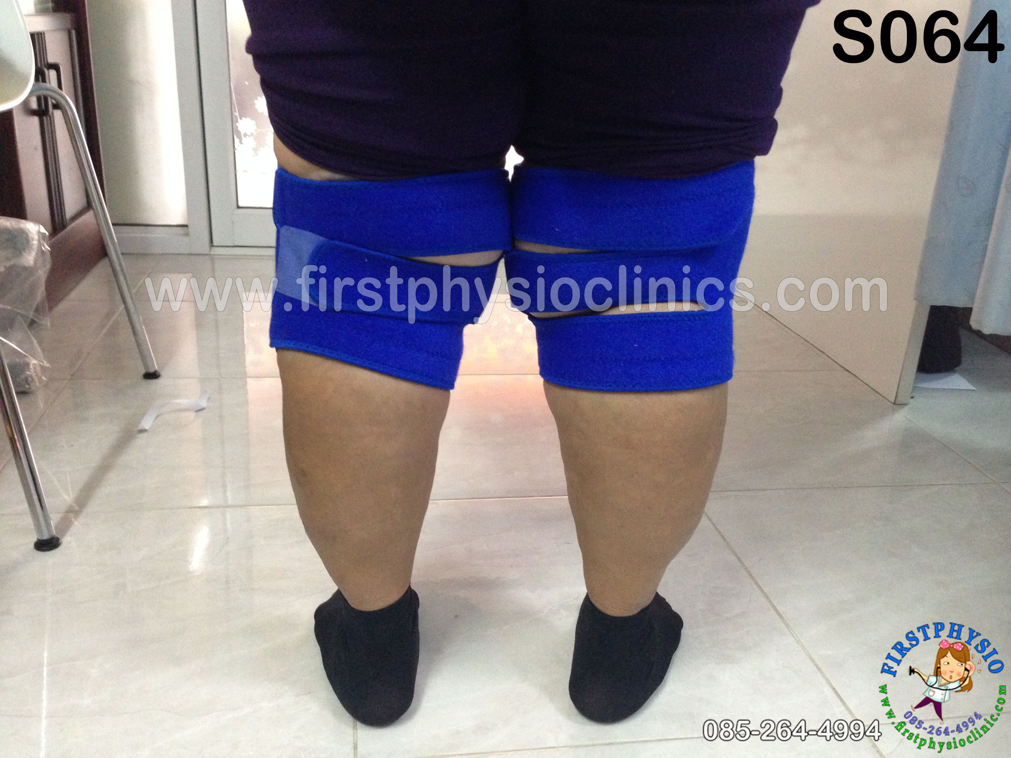 อุปกรณ์พยุงข้อเข่าสำหรับคนอ้วนมาก (Knee obesity)