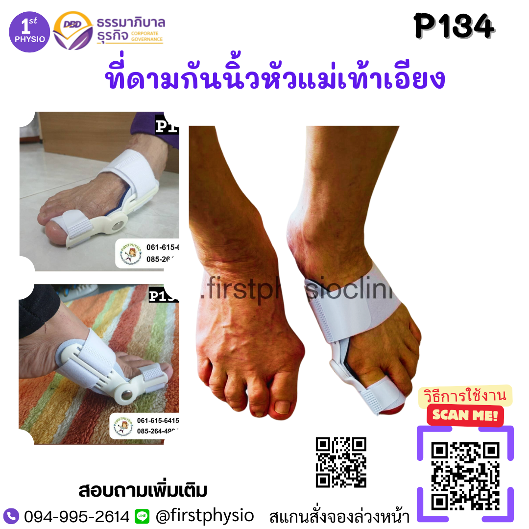 ที่ดามกันนิ้วหัวแม่เท้าเอียง/ที่ดามกันนิ้วโป้งเท้าเอียง/อุปกรณ์ดามนิ้วเท้าเก/อุปกรณ์แก้เท้าผิดรูป