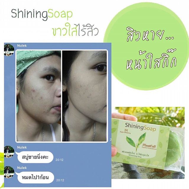 สบู่ชายนิ่ง สบู่จากสเต็มเซลล์พืช ธรรมชาติล้วนๆ ลดสิวได้ทั้งผิวหน้าและผิวกาย