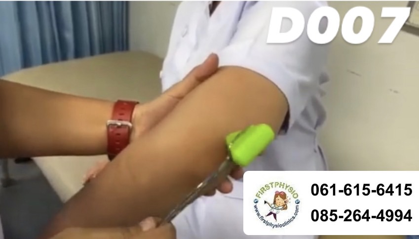 ไม้เคาะ Jerk/ ไม้เคาะเข่า/ค้อนเคาะเข่า/ค้อนยาง/KNEE JERK