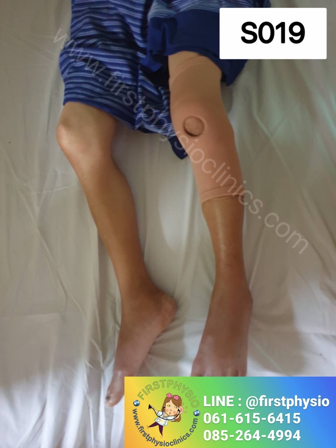 ผ้ายืดลดเข่า พยุงข้อเข่า ที่พยุงข้อเข่า พยุงเข่า สายรัดเข่า อุปกรณ์พยุงเข่า อุปกรณ์พยุงเข่า (Knee Support)ไม่มีแกนด้านข้าง [Knee Support]