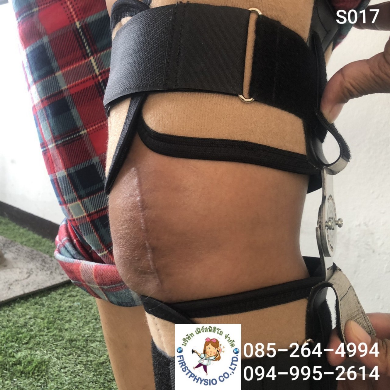 อุปกรณ์พยุงเข่าปรับองศาได้แบบสั้น/ประคองเข่าปรับมุม/พยุงเข่าแกนอลูมิเนียม Hinge Knee Support