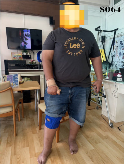 อุปกรณ์พยุงข้อเข่าสำหรับคนอ้วนมาก (Knee obesity)