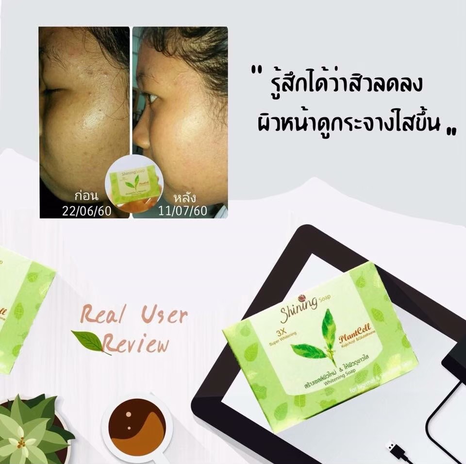 สบู่ชายนิ่ง สบู่จากสเต็มเซลล์พืช ธรรมชาติล้วนๆ ลดสิวได้ทั้งผิวหน้าและผิวกาย