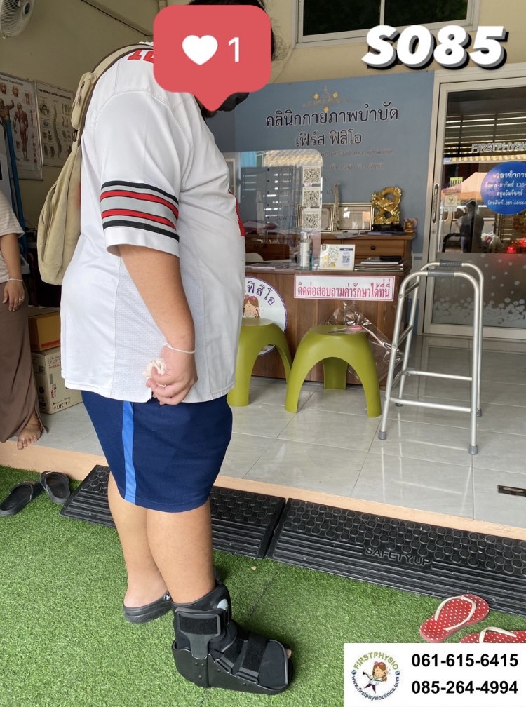 รองเท้าเฝือกลม แบบสั้น / เฝือกลม /รองเท้าหลังถอดเฝือก / รองเท้าเฝือก (air cast)/อุปกรณ์ช่วยพยุงเท้าและข้อเท้า เฝือกเท้าและข้อเท้า ป้องกันการกระแทกลดอาการบาดเจ็บ ป้องกันกระดูกเคลื่อนผิดที่