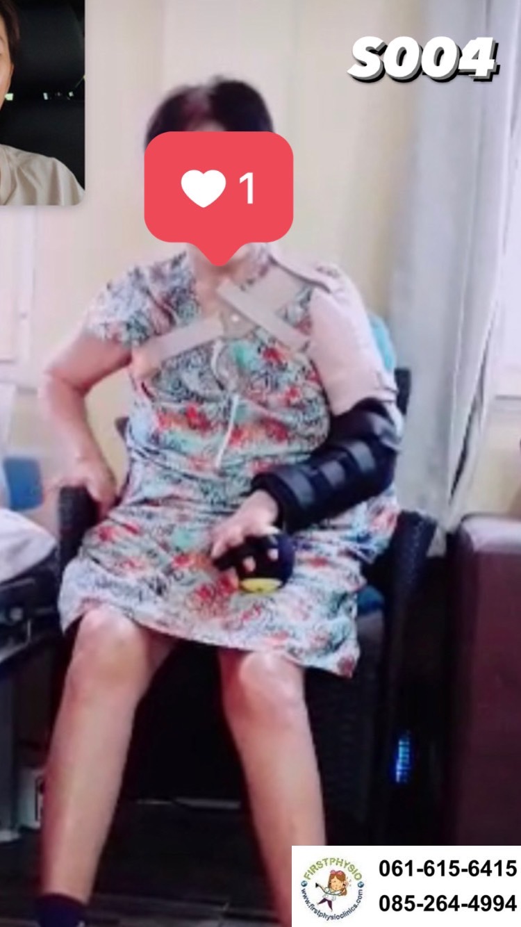 พยุงข้อไหล่หลวม พยุงไหล่ ที่พยุงไหล่ สายรัดพยุงไหล่ปรับได้ ประคองหัวไหล่ สายรัดไหล่ สายรัดพยุงไหล่ shoulder support Bobath Sling