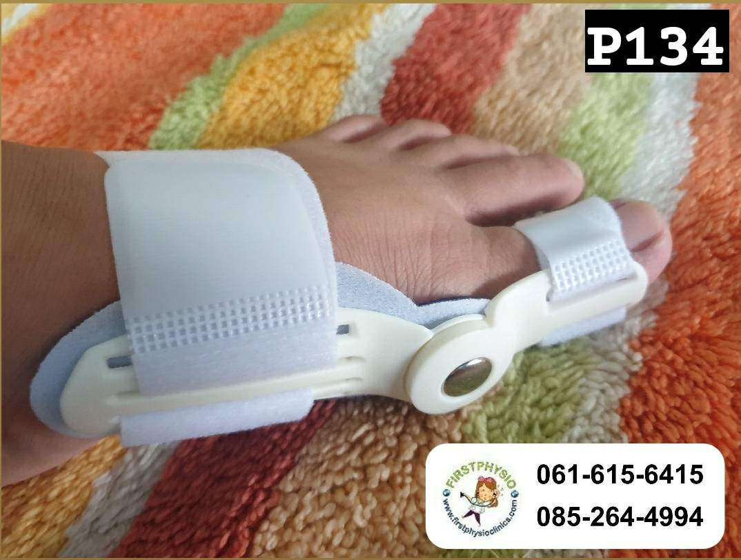 ที่ดามกันนิ้วหัวแม่เท้าเอียง/ที่ดามกันนิ้วโป้งเท้าเอียง/อุปกรณ์ดามนิ้วเท้าเก/อุปกรณ์แก้เท้าผิดรูป