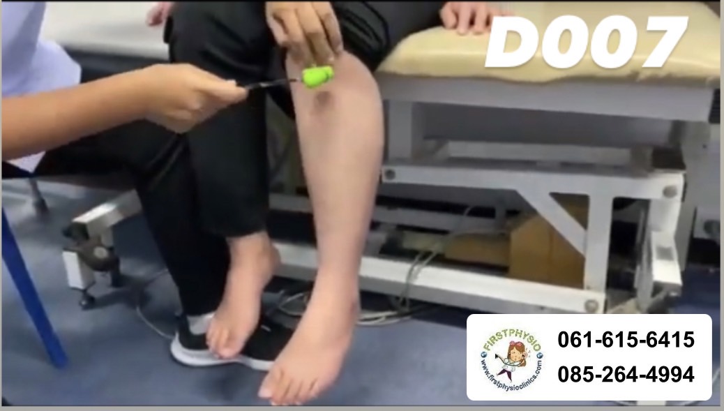 ไม้เคาะ Jerk/ ไม้เคาะเข่า/ค้อนเคาะเข่า/ค้อนยาง/KNEE JERK