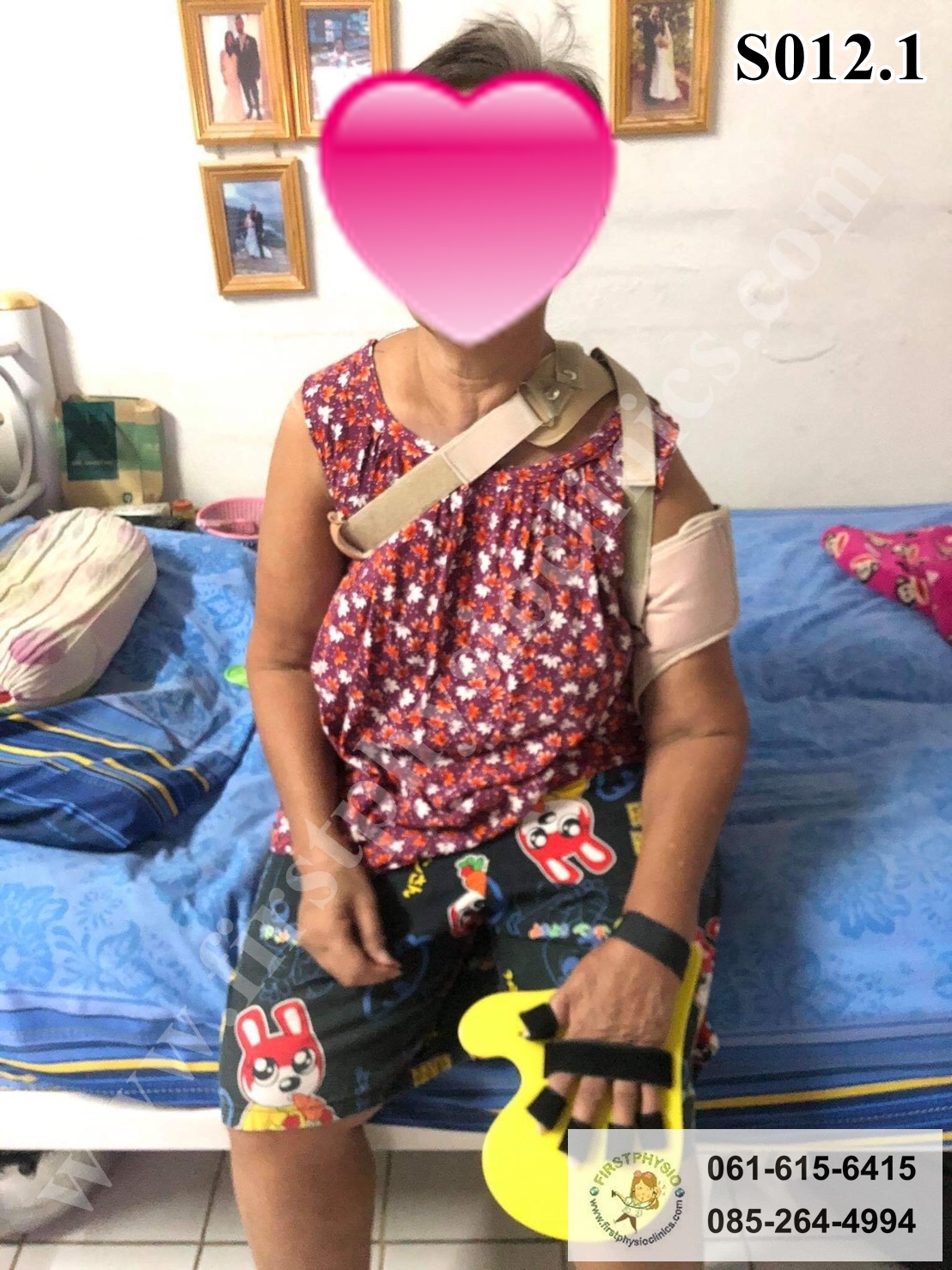 อุปกรณ์ดามกันนิ้วมืองอ /อุปกรณ์กายภาพนิ้ว/อุปกรณ์เหยียดนิ้วมือ/พลาสติกดามข้อมือ/palmar correction splint