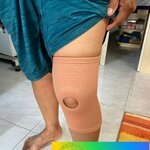 ผ้ายืดลดเข่า พยุงข้อเข่า ที่พยุงข้อเข่า พยุงเข่า สายรัดเข่า อุปกรณ์พยุงเข่า อุปกรณ์พยุงเข่า (Knee Support)ไม่มีแกนด้านข้าง [Knee Support]