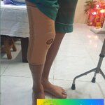 พยุงข้อเข่าและสะบ้าแบบมีแกน พยุงเข่า ที่พยุงเข่า อุปกรณ์พยุงเข่า พยุงหัวเข่ามีแกน2ข้าง Knee Support แบบมีแกน พยุงเข่าแบบมีแกน [Open Patella Flexible Bars]