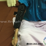FIRSTPHYSIO/อุปกรณ์เหยียดข้อศอกผู้ใหญ่/ดามข้อศอก/ข้อศอกติด//Elbow Stretch/อุปกรณ์ช่วยเหยียดศอกตรง/ที่ดัดข้อศอกตรง/อุปกรณ์ดามศอกลดเกร็ง