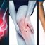 สายรัดเข่า แบบมีรูตรงกลาง Knee Support ขนาดฟรีไซส์ พร้อมส่งในไทย
